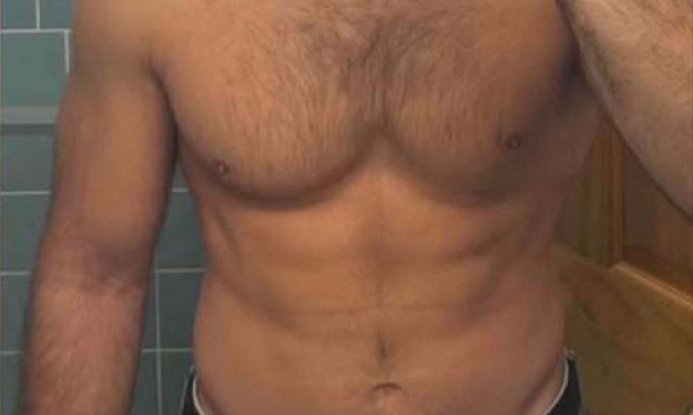 After Transformation 1