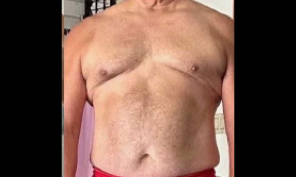 After Transformation 2