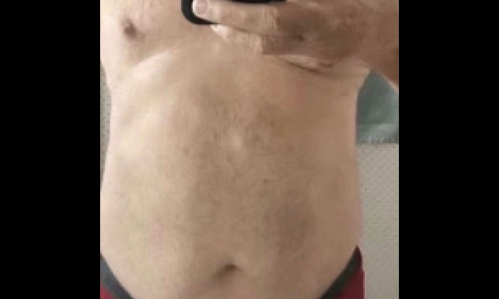 Before Transformation 2