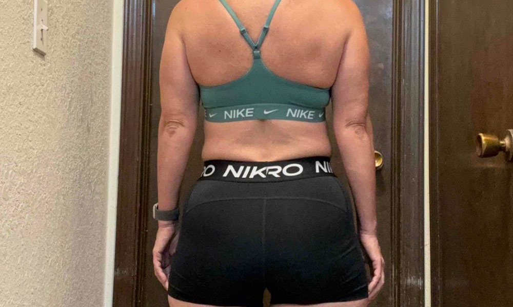 Before Transformation 3